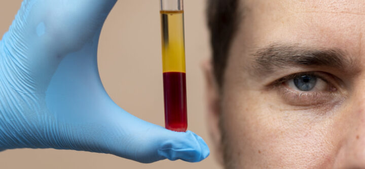 smiley-man-hand-holding-prp-vial